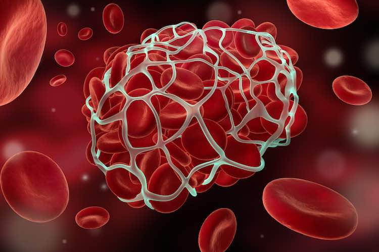 7-foods-to-prevent-a-deadly-blood-clot